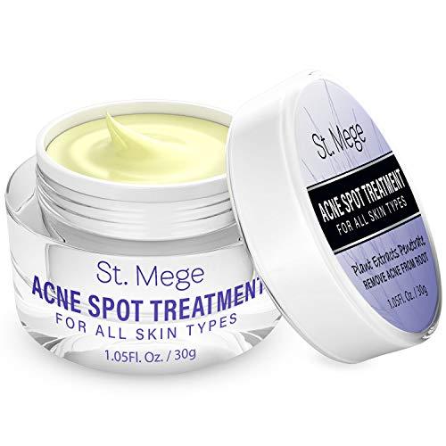Acne Whitening Cream by St.Mege - Penetrate to Treat Acne from Root, Mois-turizing Spot Treatment