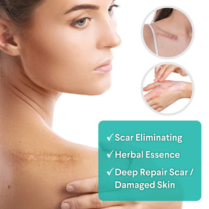 Scar Removal Cream, Scar Cream For Old Scars - Stretch Mark Removal Cream for Men & Women - Stretch Marks Relief and Burns Repair, Face Skin Repair Cream